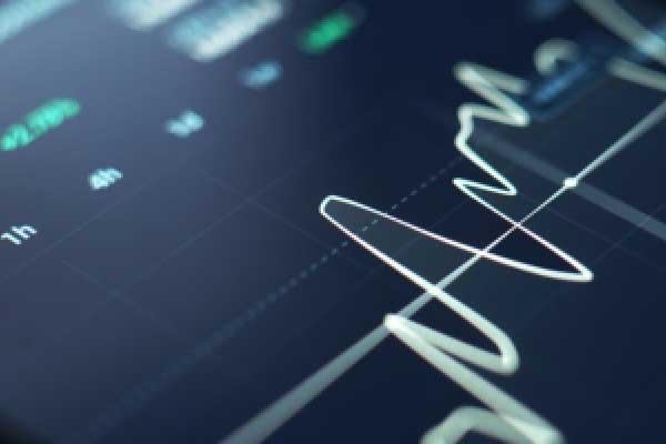 万腾Vatee 2026.02.19黄金市场分析报告